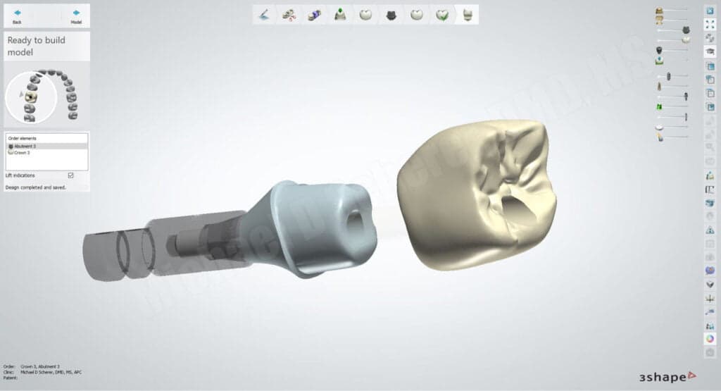 3Shape CAD/CAM Technology